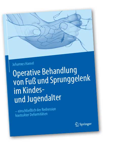 Operative Behandlung von Fuß und Sprunggelenk im Kindes- und Jugendalter – einschließlich der Redression kontrakter Deformitäten