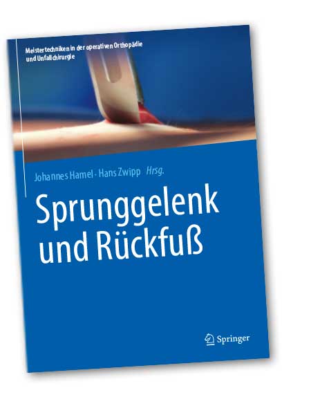 Sprunggelenk und Rückfuß – Meistertechniken in der operativen Orthopädie und Unfallchirurgie