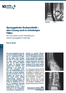 Sprunggelenks-Endoprothetik – eine Lösung auch in schwierigen Fällen