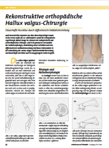 Rekonstruktive orthopädische Hallux valgus-Chirurgie